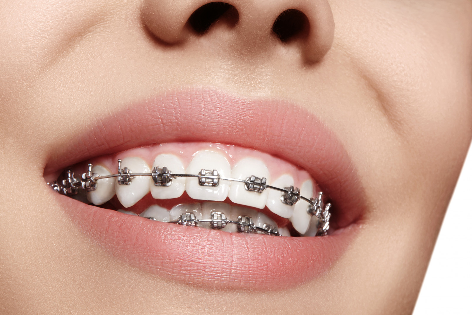 Orthodontist